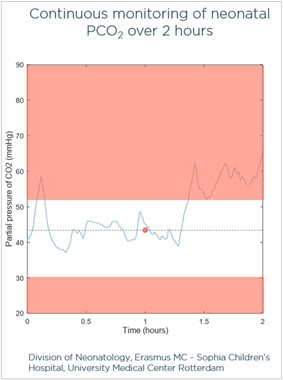 continious monitoring of neonatal pco2