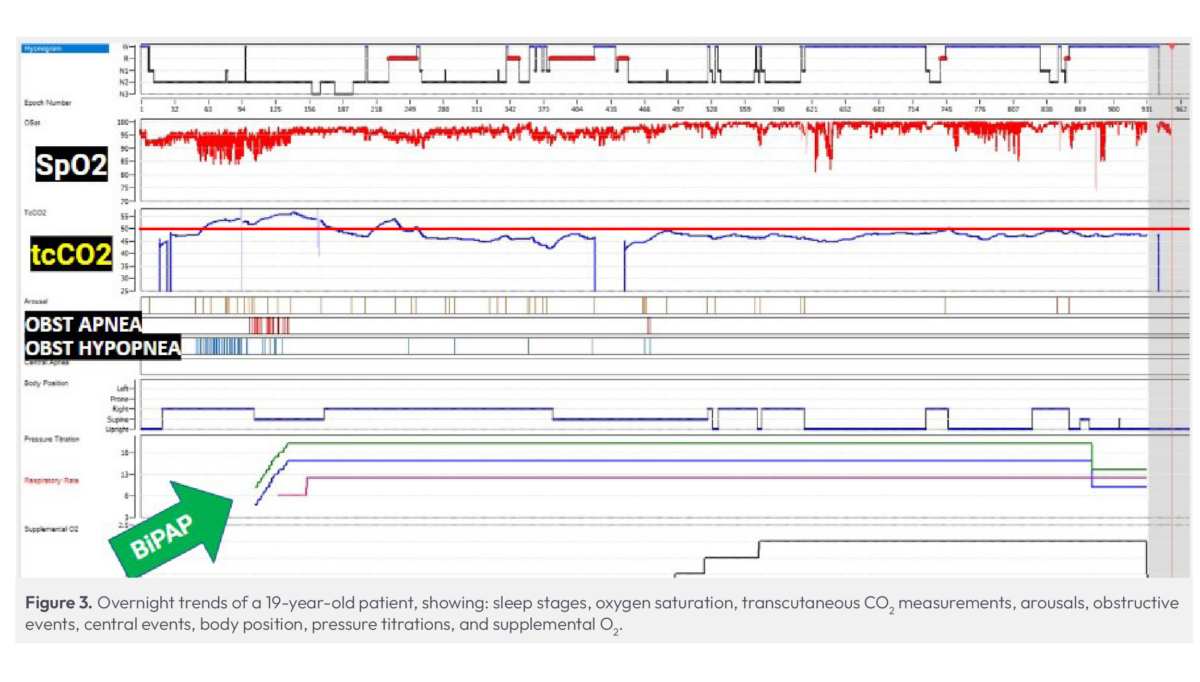 Lisa DeGuzman Case Study FIgure-03