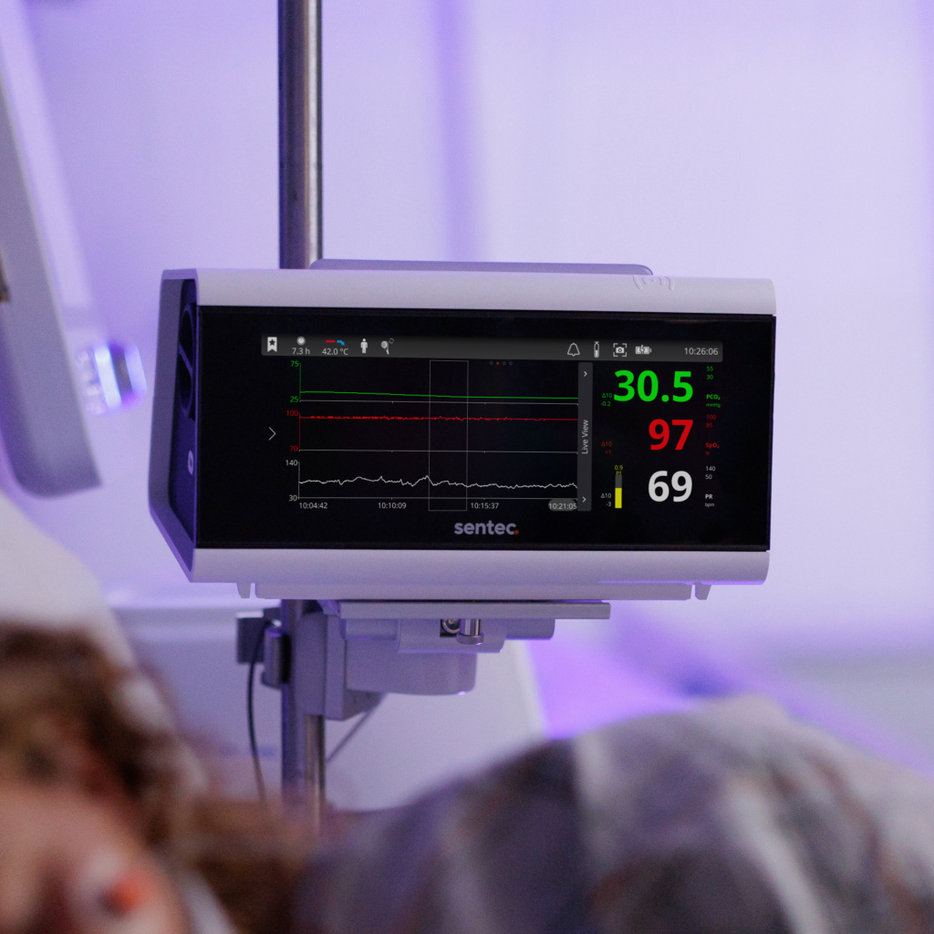 Tco2 Syntec Monitoring Is It Time to Reconsider Transcutaneous CO2 Monitoring for Your Unit ...