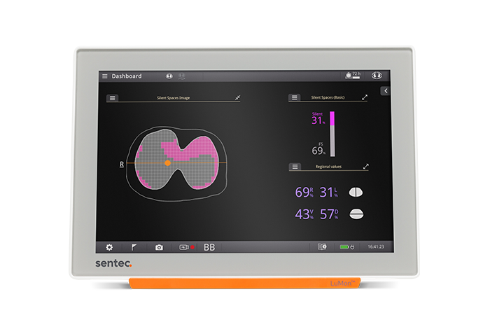 Sentec Transcutaneous Transcutaneous CO₂ Monitoring in the NICU | Sentec