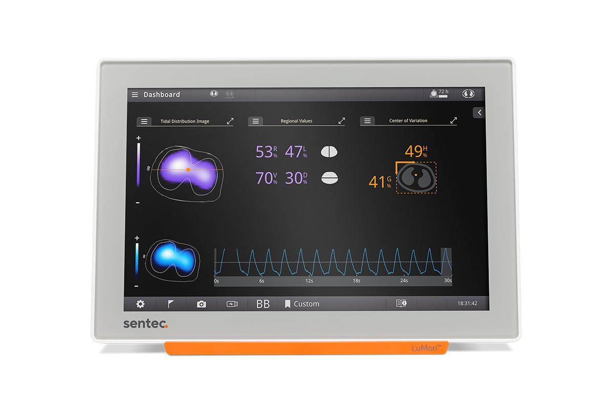 EIT-LuMon-Monitor-Hero-1200×789